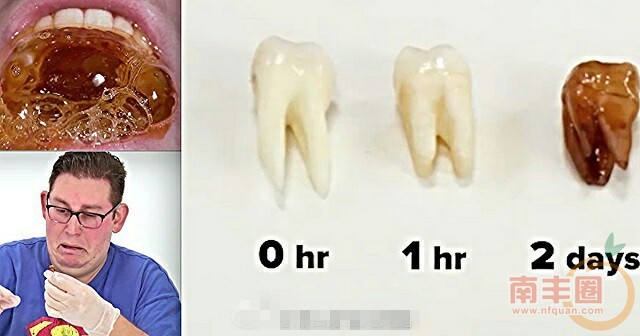 a37dc983gw1f2m1rx47f2j20hs09c0tt.jpg